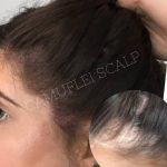 camuflei scalp (3)