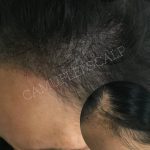 camuflei scalp (4)